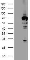 HEK293T cells were transfected with the pCMV6-ENTRY control (Left lane) or pCMV6-ENTRY NMT2 (Right lane) cDNA for 48 hrs and lysed