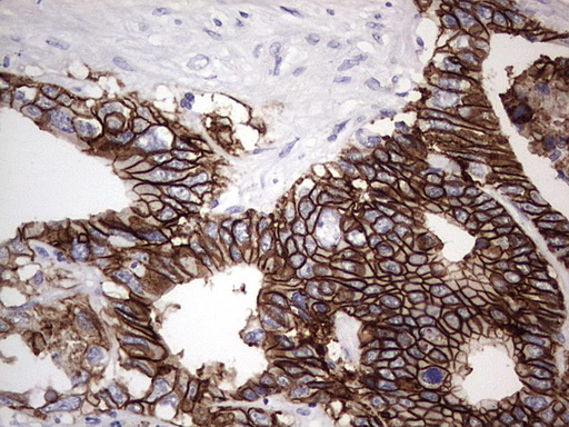 m07626 anti boule boll mouse monoclonal antibody clone id oti2d11 ihc testing 4