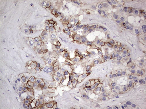 m07626 anti boule boll mouse monoclonal antibody clone id oti2d11 ihc testing 6