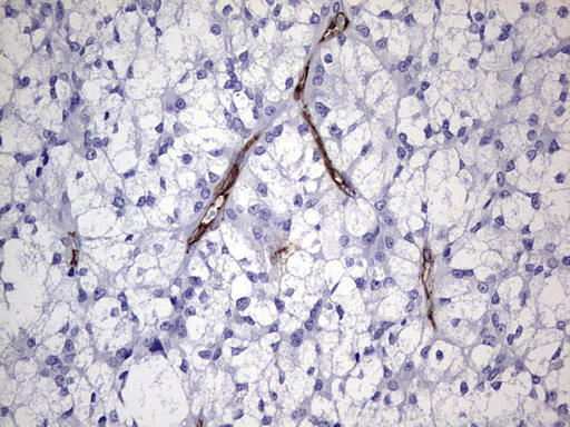 m07632 anti r cadherin cdh4 mouse monoclonal antibody clone id oti4f5 ihc testing 4