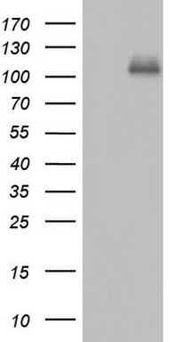 HEK293T cells were transfected with the pCMV6-ENTRY control (Left lane) or pCMV6-ENTRY CDH4 (Right lane) cDNA for 48 hrs and lysed
