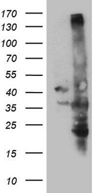 HEK293T cells were transfected with the pCMV6-ENTRY control (Left lane) or pCMV6-ENTRY C16orf57 (Right lane) cDNA for 48 hrs and lysed. Equivalent amounts of cell lysates (5 ug per lane) were separated by SDS-PAGE and immunoblotted with anti-C16orf57 (1:2000).
