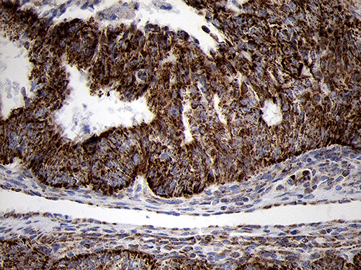 m07659 anti timm8a mouse monoclonal antibody clone id oti5c8 ihc testing 3