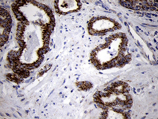 m07659 anti timm8a mouse monoclonal antibody clone id oti5c8 ihc testing 4