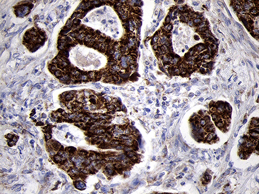 m07659 anti timm8a mouse monoclonal antibody clone id oti5c8 ihc testing 5
