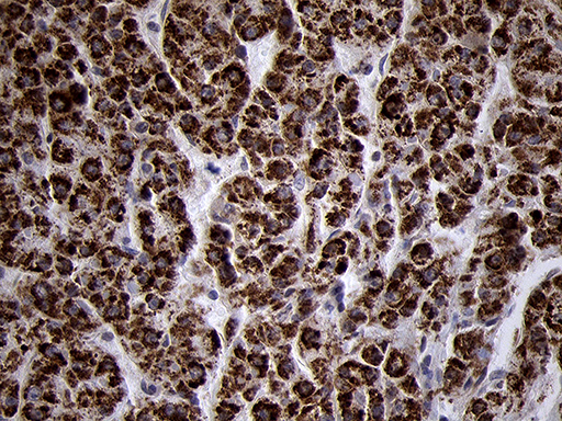 m07659 anti timm8a mouse monoclonal antibody clone id oti5c8 ihc testing 6