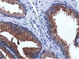 Immunohistochemical staining of paraffin-embedded Human prostate tissue within the normal limits using anti-ADI1 mouse monoclonal antibody