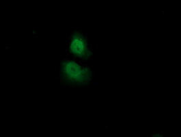 Anti-ADI1 mouse monoclonal antibody (M07662) immunofluorescent staining of COS7 cells transiently transfected by pCMV6-ENTRY ADI1