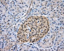 Immunohistochemical staining of paraffin-embedded pancreas tissue within the normal limits using anti-CAPZA1 mouse monoclonal antibody