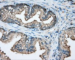 m07665 anti capza1 mouse monoclonal antibody clone id oti2g4 ihc testing 4