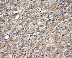 m07665 anti capza1 mouse monoclonal antibody clone id oti2g4 ihc testing 5