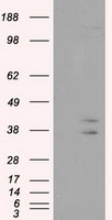 HEK293T cells were transfected with the pCMV6-ENTRY control (Left lane) or pCMV6-ENTRY CAPZA1 (Right lane) cDNA for 48 hrs and lysed