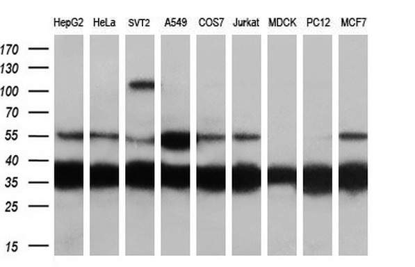 Western blot analysis of extracts (35ug) from 9 different cell lines by using anti-CAPZA1 monoclonal antibody (HepG2: human; HeLa: human; SVT2: mouse; A549: human; COS7: monkey; Jurkat: human; MDCK: canine; PC12: rat; MCF7: human) (1:200)