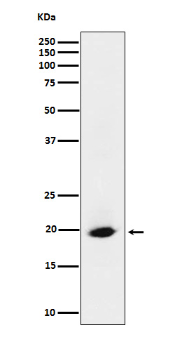 Western blot analysis of SRP19 expression in HeLa cell lysate.