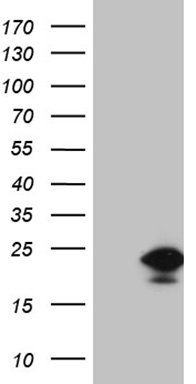 HEK293T cells were transfected with the pCMV6-ENTRY control (Left lane) or pCMV6-ENTRY EDF1 (Right lane) cDNA for 48 hrs and lysed