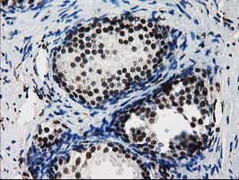 m07684 anti fkbpl mouse monoclonal antibody clone id oti2d8 ihc testing 2