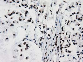 m07684 anti fkbpl mouse monoclonal antibody clone id oti2d8 ihc testing 5