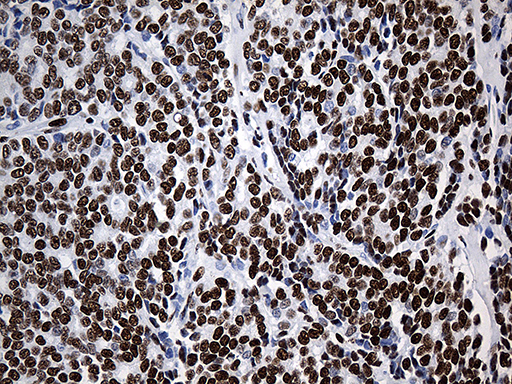 m07691 anti hnrph1 hnrnph1 mouse monoclonal antibody clone id oti5d11 ihc testing 10