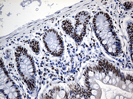 m07691 anti hnrph1 hnrnph1 mouse monoclonal antibody clone id oti5d11 ihc testing 11