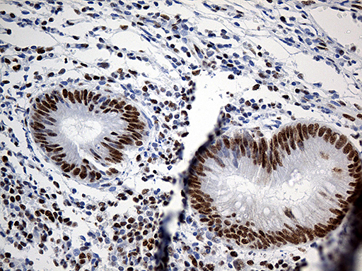 m07691 anti hnrph1 hnrnph1 mouse monoclonal antibody clone id oti5d11 ihc testing 12
