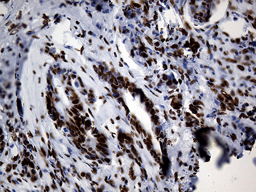 m07691 anti hnrph1 hnrnph1 mouse monoclonal antibody clone id oti5d11 ihc testing 13