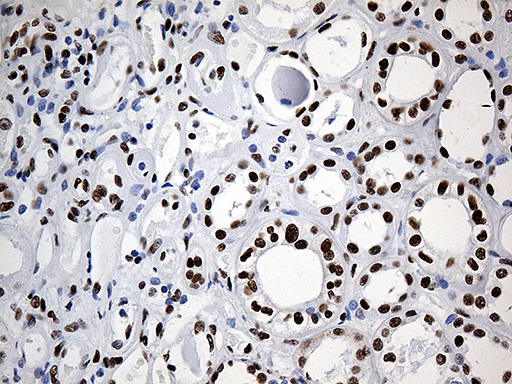 m07691 anti hnrph1 hnrnph1 mouse monoclonal antibody clone id oti5d11 ihc testing 14