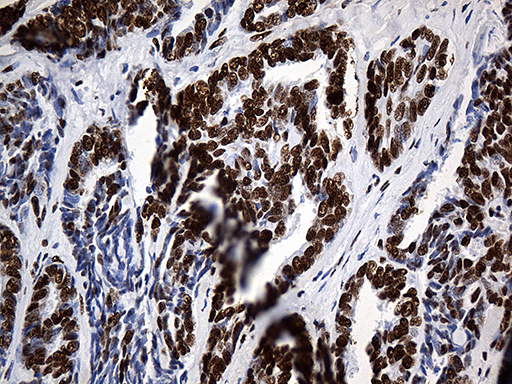 m07691 anti hnrph1 hnrnph1 mouse monoclonal antibody clone id oti5d11 ihc testing 4
