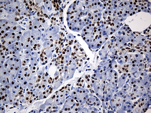 m07691 anti hnrph1 hnrnph1 mouse monoclonal antibody clone id oti5d11 ihc testing 5