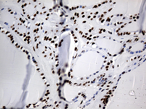 m07691 anti hnrph1 hnrnph1 mouse monoclonal antibody clone id oti5d11 ihc testing 6