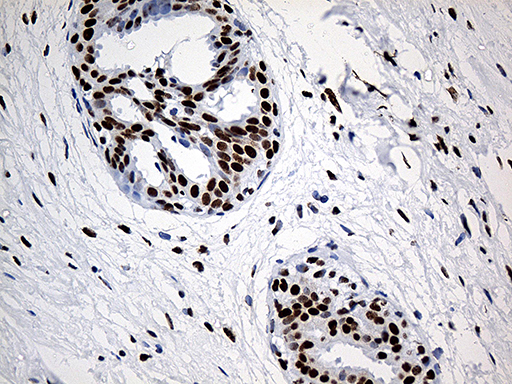 m07691 anti hnrph1 hnrnph1 mouse monoclonal antibody clone id oti5d11 ihc testing 7