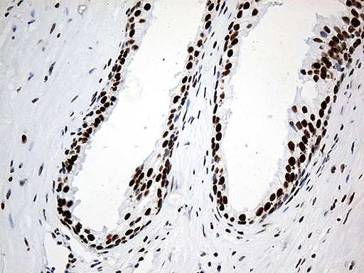 m07691 anti hnrph1 hnrnph1 mouse monoclonal antibody clone id oti5d11 ihc testing 8