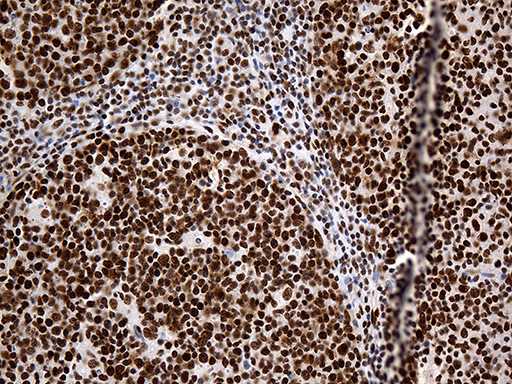 m07691 anti hnrph1 hnrnph1 mouse monoclonal antibody clone id oti5d11 ihc testing 9