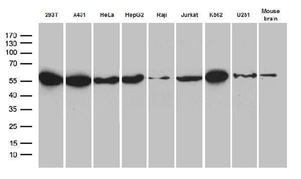 Western blot analysis of extracts (35ug) from 8 cell lines and human brain tissue lysate by using anti-HNRNPH1 monoclonal antibody (1:500)