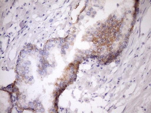 m07695 anti mcee mouse monoclonal antibody clone id oti1b5 ihc testing 4