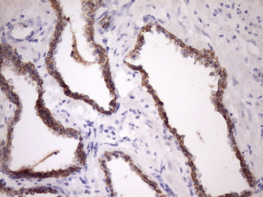 m07695 anti mcee mouse monoclonal antibody clone id oti1b5 ihc testing 5