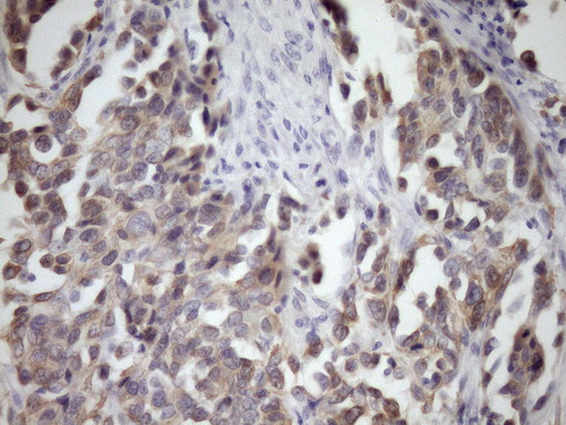 m07695 anti mcee mouse monoclonal antibody clone id oti1b5 ihc testing 6