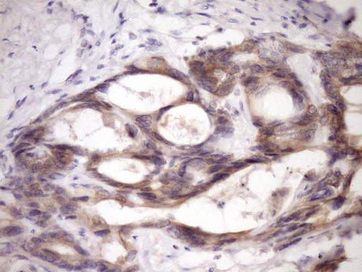 m07695 anti mcee mouse monoclonal antibody clone id oti1b5 ihc testing 7
