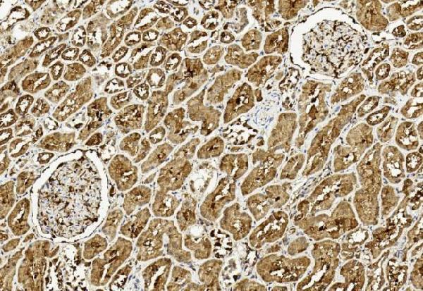 m07706 1 anti ulk3 antibody c term ihc testing 1