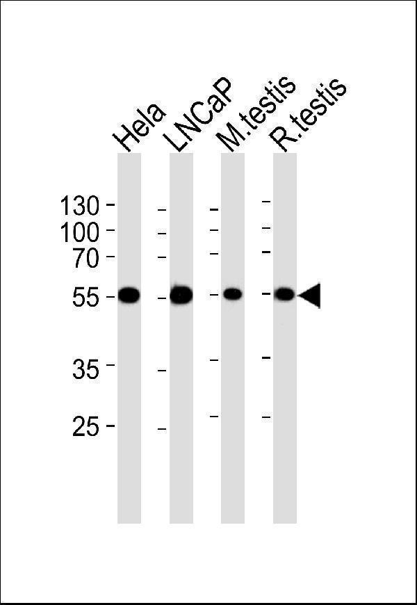 m07706 1 anti ulk3 antibody c term wb testing 2