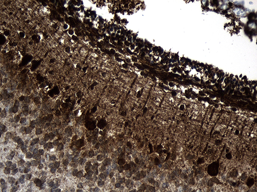Immunohistochemical staining of paraffin-embedded Human embryonic cerebellum within the normal limits using anti-CCT4 mouse monoclonal antibody