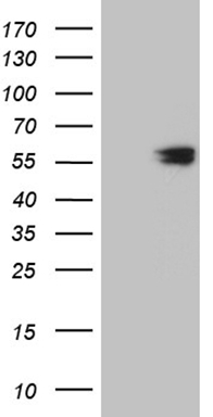 HEK293T cells were transfected with the pCMV6-ENTRY control (Left lane) or pCMV6-ENTRY CCT4 (Right lane) cDNA for 48 hrs and lysed