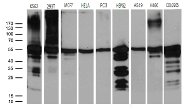 Western blot analysis of extracts (35ug) from 9 different cell lines by using anti-CCT4 monoclonal antibody (1:500)