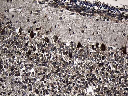 Immunohistochemical staining of paraffin-embedded Human embryonic cerebellum within the normal limits using anti-CCT4 mouse monoclonal antibody