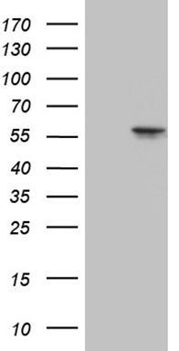 HEK293T cells were transfected with the pCMV6-ENTRY control (Left lane) or pCMV6-ENTRY CCT4 (Right lane) cDNA for 48 hrs and lysed