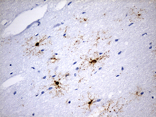 Immunohistochemical staining of paraffin-embedded Human adult brain tissue within the normal limits using anti-GPR17 mouse monoclonal antibody