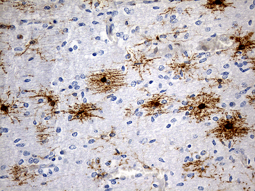 Immunohistochemical staining of paraffin-embedded Human embryonic cerebellum within the normal limits using anti-GPR17 mouse monoclonal antibody