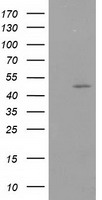 HEK293T cells were transfected with the pCMV6-ENTRY control (Left lane) or pCMV6-ENTRY PACSIN3 (Right lane) cDNA for 48 hrs and lysed