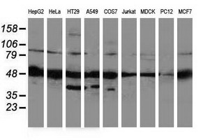 Western blot analysis of extracts (35ug) from 9 different cell lines by using anti-PACSIN3 monoclonal antibody