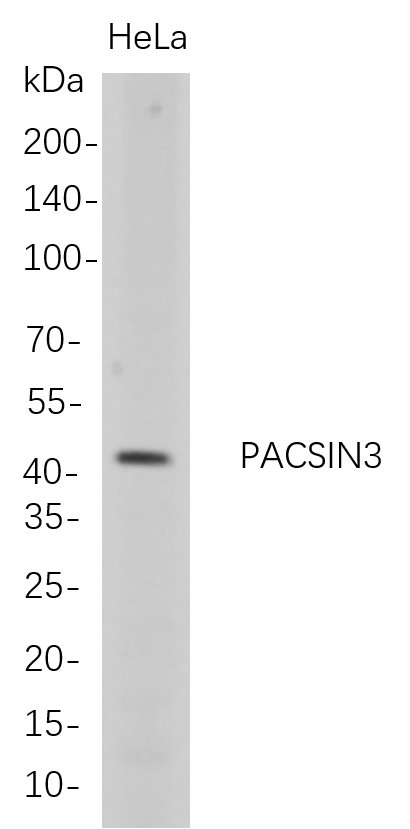 Western Blot analysis of HeLa whole cell lysates were separated by 4-20% SDS-PAGE, and the membrane was blotted with anti-PACSIN3 rabbit mAb