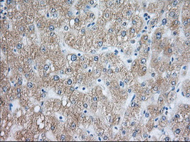 m07742 anti rab17 mouse monoclonal antibody clone id oti5e2 ihc testing 4